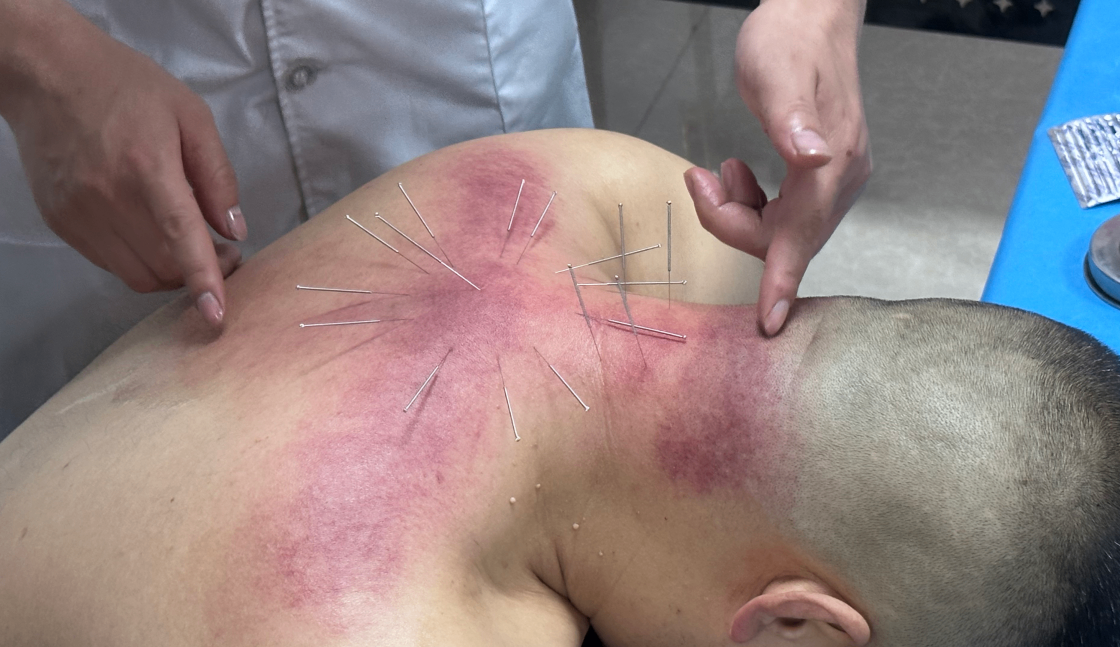 陕西中医师承培训机构哪家好